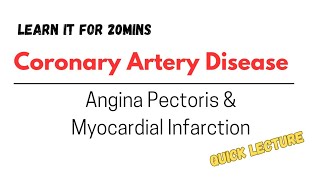 Atherosclerosis Angina Pectoris and Myocardial Infarction lecture discussion [upl. by Dragone]