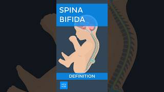 Spina bifida Definition  Kenhub spinabifida [upl. by Gerdy]