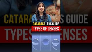 Cataract Lens Guide In Hindi Types Of Cataract Lenses [upl. by Atineb568]