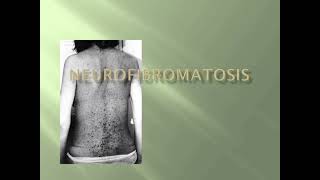 Neurofibromatosis Skin Examination mrcpch Clinical [upl. by Patrick458]