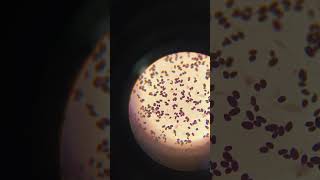 Micrococcus in urine sample gram stain \gram stain in microscope [upl. by Milicent]