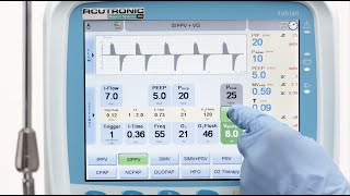 fabian HFO SIPPV Synchronized Intermittent Positive Pressure Ventilation [upl. by Notneuq]