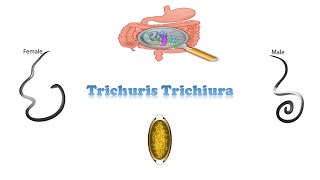 شرح trichuris trichiura [upl. by Korry127]