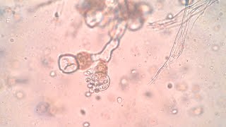 Sporangium of Pythium and Allomyces [upl. by Arva308]