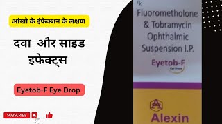 FlurometholoneampTobramycin EyetobFEye Drops [upl. by Orelia]