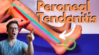 Peroneal Tendonitis Treatment 2024 Peroneus Brevis amp Longus Pain [upl. by Ameline]