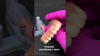 Protocolo estratificado  barra 🔥shortsvideo tpd dentist protocolo dentista prótesedentária [upl. by Ajar]