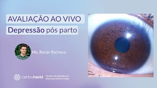 Análise irídea  Paciente com depressão pós parto iridologia microsemioticairidea depressão [upl. by Jenn]