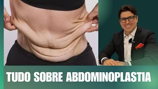 Tudo sobre Abdominoplastia  Dr Marcello Di Martino [upl. by Mia846]