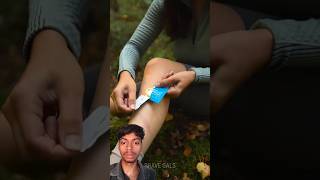 how to treat Forest injuries🥵🤯camping survival bushcraft outdoors lifehacks shorts [upl. by Duke720]