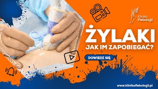 ŻYLAKI  jak im zapobiegać [upl. by Doelling]