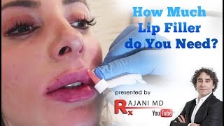 How Much Lip Filler do You Need [upl. by Adnolay]