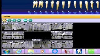 Guru Teach  integration with Dentrix and Dexis [upl. by Aihselat732]