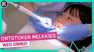 ONTSTOKEN MELKKIES TREKKEN 🦷  TOPDOKS [upl. by Watt]