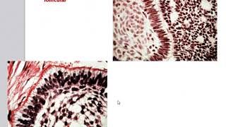 Odontogenic Tumors [upl. by Tigram920]