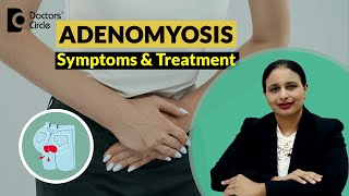 Heavy Painful Periods Adenomyosis of UterusSymptoms amp Treatment DrRashmi Yogish Doctors Circle [upl. by Alexine]