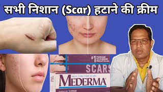 mederma cream  Mederma for acne scars  Mederma Advanced scar gel review [upl. by Nahshon]