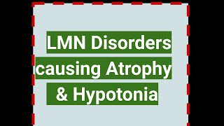 LOWER MOTOR Disorders causing Atrophy amp Hypotonia [upl. by Nosnhoj]