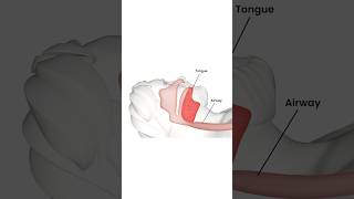 What is Obstructive Sleep Apnea  Capital ENT amp Sinus Center [upl. by Ha723]