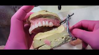 quotWatch How Denture Teeth Are Perfectly Set StepbyStep Craftsmanship Tutorialquot [upl. by Modeste399]