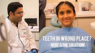 TEETH IN WRONG PLACE How To Fix dentist shortsindia [upl. by Miquela489]