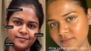 My night skincare routine  textured acne prone skin  Tamil [upl. by Atinra]