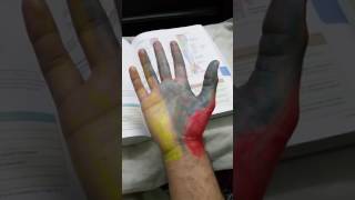 Cutaneous innervation of hand [upl. by Riti]