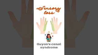 Sensory loss due to Guyon’s canal syndrome shorts ulnarnerve clinicalanatomy [upl. by Costello]