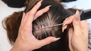 ASMR Intense Scalp SCRATCHING and NITPICKING with Nails Real Person [upl. by Solram138]