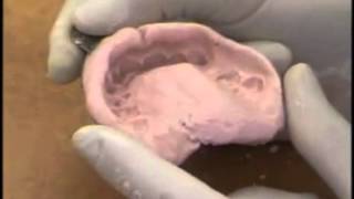 Upper Alginate Impression Evaluation [upl. by Harbird885]