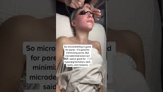 Benefits of Microdermabrasion [upl. by Petey405]