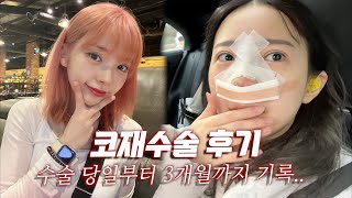 코재수술 VLOG✨10년 전에 했던 코수술 부작용이 왔었어요🥲 [upl. by Leighland]