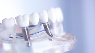 « Le blanchiment des dents  une tendance à suivre  » [upl. by Naitsihc]