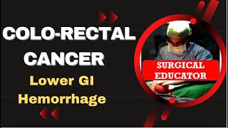 COLORECTAL CARCINOMA How To DIAGNOSE amp TREAT Lower GI Hemorrhage [upl. by Noby]