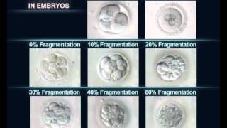 Classification des embryons FIV par leur degré de fragmentation [upl. by Ahsenac]