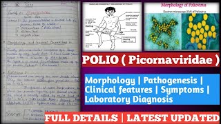 polio  poliomyelitis in hindi  polio vaccination  polio disease in hindi  polio in hindi [upl. by Jo-Anne670]