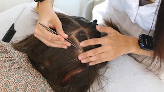 ASMR LICE Check amp Hairline Exam  Removal with Tweezers Real Person [upl. by Bille]