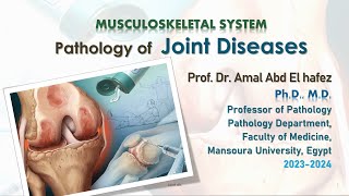 Joint Diseases OsteoarthritisRheumatoid ArthritisSeronegative Arthritis Lectureشرح محاضرة [upl. by Barden]