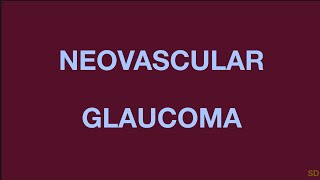 Glaucoma Session 19 Secondary Angle Closure Glaucoma Part 2 Neovascular Epithelial ingrowth [upl. by Rossner161]