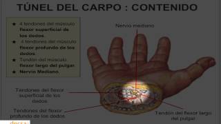 Síndrome Túnel Carpiano 🤚 mano entumecida Tratamiento [upl. by Anhoj]