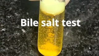 Bile Salt Test [upl. by Elora]