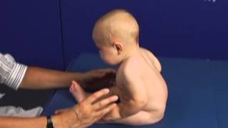 6 Month Old Babies in Pull to Sit Movement Typical and Atypical Development Comparison [upl. by Donnamarie124]