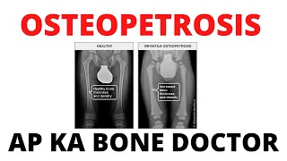 OSTEOPETROSIS OR MARBLE BONE DISEASE  EPISODE 47 [upl. by Nolubez]