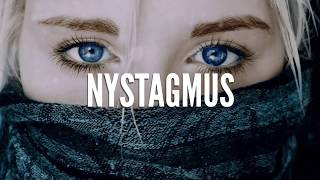 Nystagmus How Do We See It [upl. by Lig]