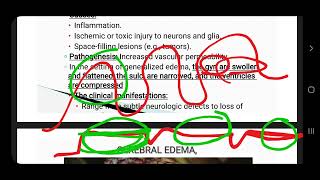 cerebral edema herniation hydrocephalus CVA and CNS infection [upl. by Enirahtak]