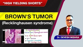 High Yielding Shorts43 HYS43  Browns Tumor by Dr Devesh Mishra [upl. by Euqinaj]