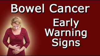 Early Warning Signs Of Bowel Cancer [upl. by Thenna819]