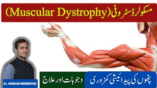 Duchenne Muscular Dystrophy DMD Symptoms Diagnosis Treatment amp Management  Muscular dystrophy [upl. by Elayor412]