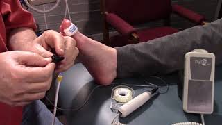 How to perform a TBI Toe Brachial Index with simpleABI PPG Kit [upl. by Gwynne]