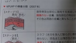 看護学生講座 81 皮膚 ｢NPUAPの褥瘡深度分類 Ⅰ～Ⅳ の覚えるポイント｣ [upl. by Oribella267]